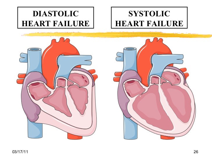 Chronic systolic and diastolic heart failure