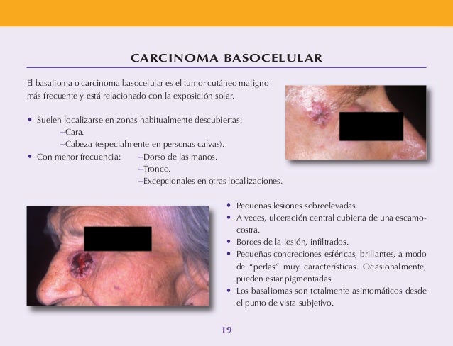 Si hay un tratamiento contra la dermatitis atopicheskogo de la dermatitis
