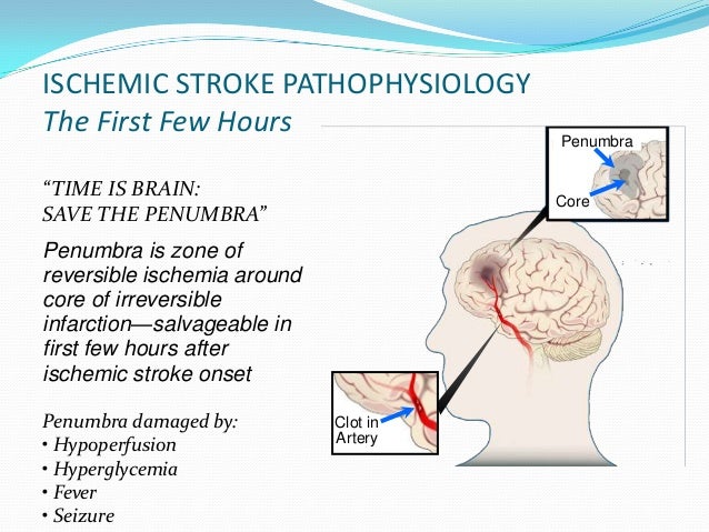 management of ischemic stroke part 1 Critical care management of acute ischemic stroke nerissa u ko, md •blood pressure management •post-stroke cerebral edema • ninds part 1 • ninds part 2. management of ischemic stroke part 1 Critical care management of acute ischemic stroke nerissa u ko, md •blood pressure management •post-stroke cerebral edema • ninds part 1 • ninds part 2.