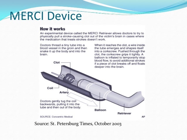 Mini stroke leg tia poor symptoms