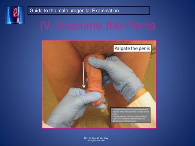 Penis Examination Video 97