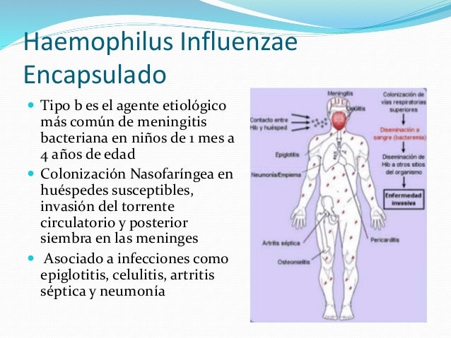 Haemophilus influenzae by noelia nicay ruz