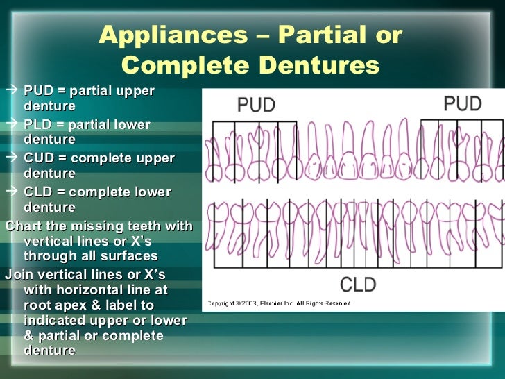 hard tissue charting dental surfaces chart