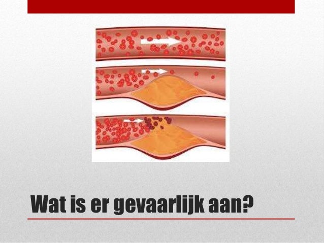 naadlekkage na darmoperatie symptomen