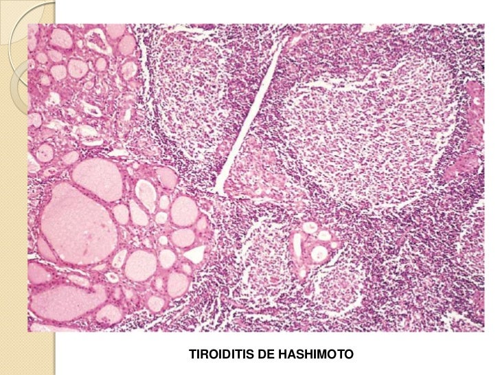Simplemente significa como consumir chia para bajar de peso yodo radiactivo administra como consumir chia para bajar de peso