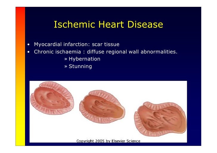 heart failure intro This module offers a summary of the key latest developments in chronic heart failure management, and the practical implications for doctors. heart failure intro This module offers a summary of the key latest developments in chronic heart failure management, and the practical implications for doctors.