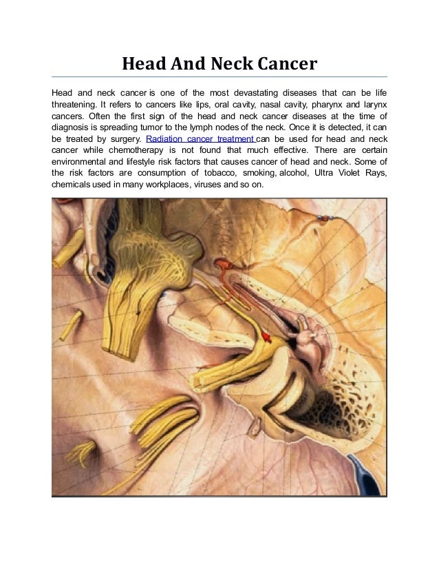 Cancer Of The Head And Neck Myers Pdf Free