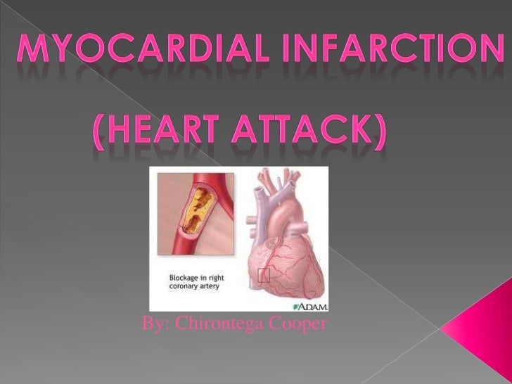 heart-attack-ppt