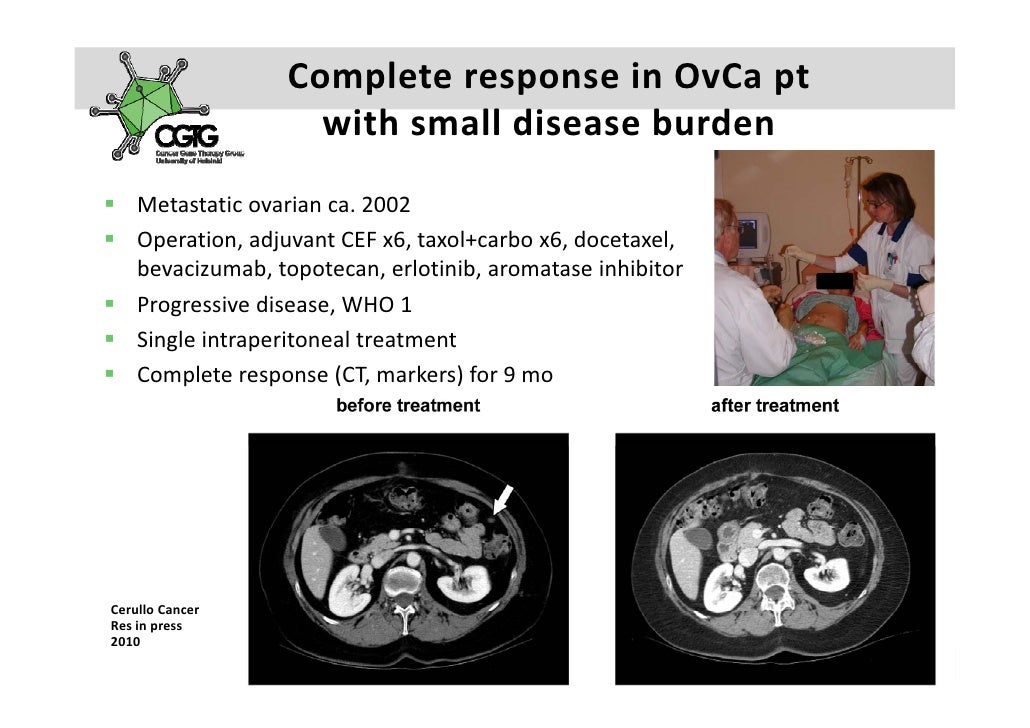 asbestos exposure danger evaluation find a lawyer perth