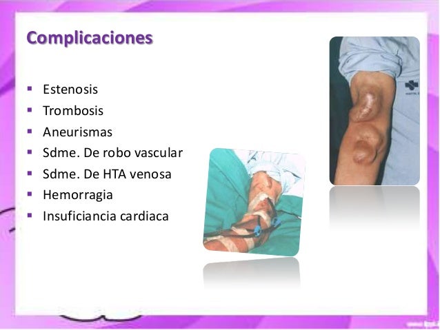 Las pastillas contraceptivas a varikoze matki