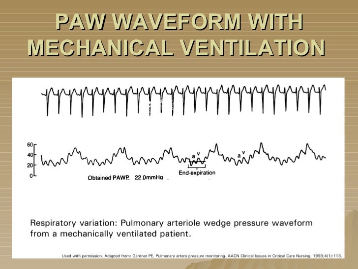 Hemodynamics Basic Concepts