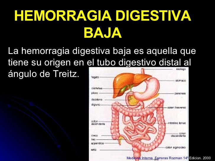 HEMORRAGIA DIGESTIVA BAJA hemorragia digestiva baja: