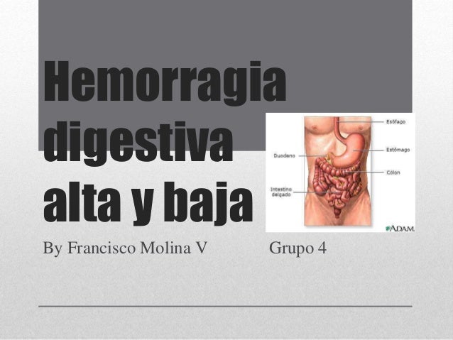 HEMORRAGIA DIGESTIVA BAJA hemorragia digestiva baja: