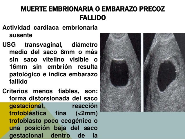 lograr un embarazo exitoso