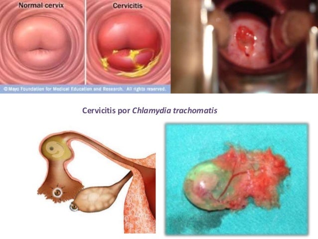 La vitamina e en las cápsulas la instrucción de la aplicación para la persona de los granos