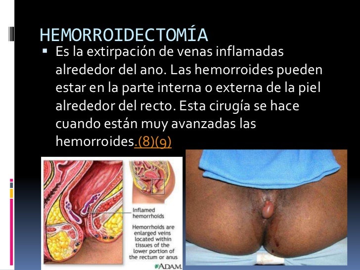 En el hospital regional hay un médico flebolog voronezh