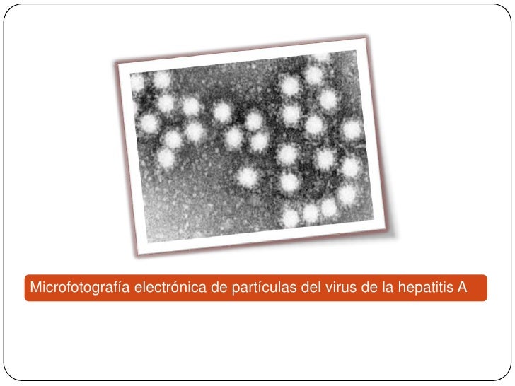 recetas para quitar grasa del abdomen Recetas para quitar grasa del abdomen eso