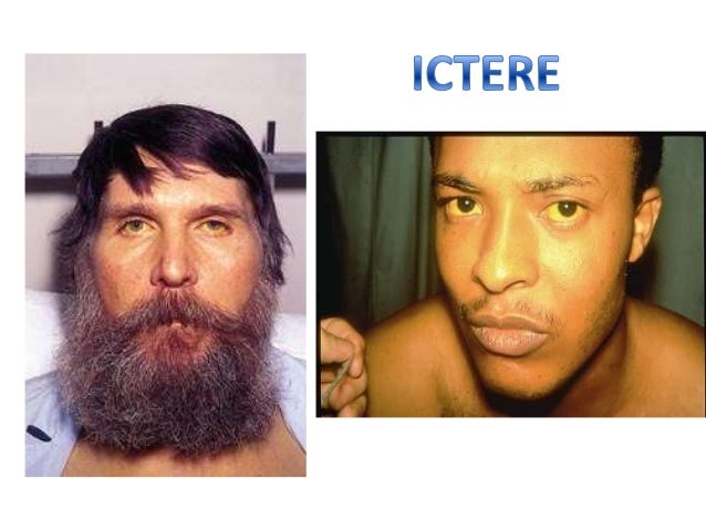 symptome most cancers bouche most cancers du rein fin de vie