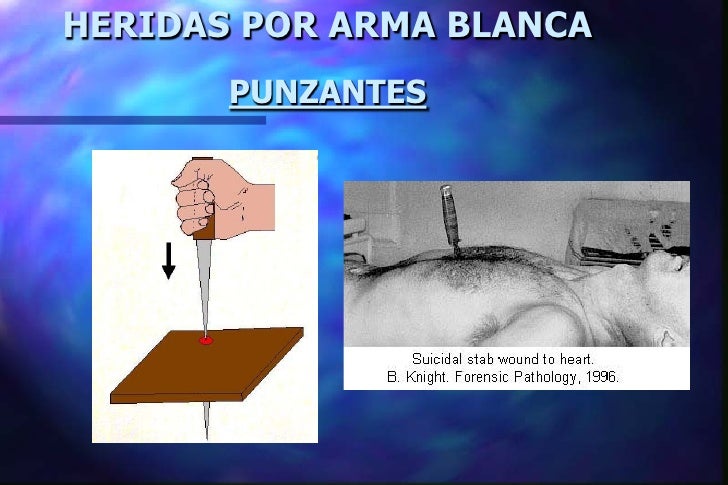 Heridas por arma_blanca