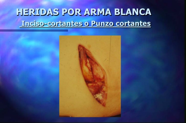 Heridas por arma_blanca