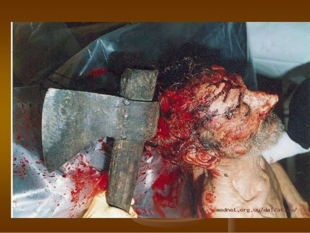 Heridas por arma blanca