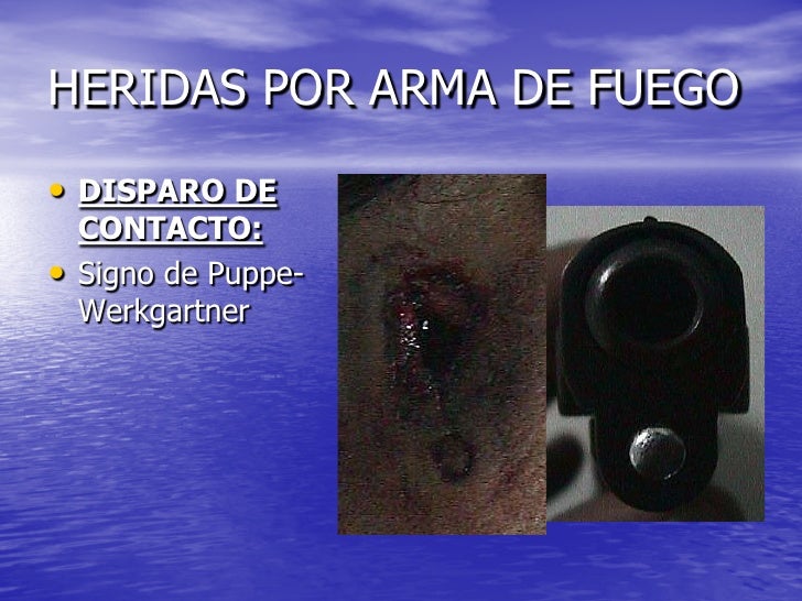 MEDICINA LEGAL Y CRIMINALISTICA MEDICINA LEGAL Y CRIMINALISTICA