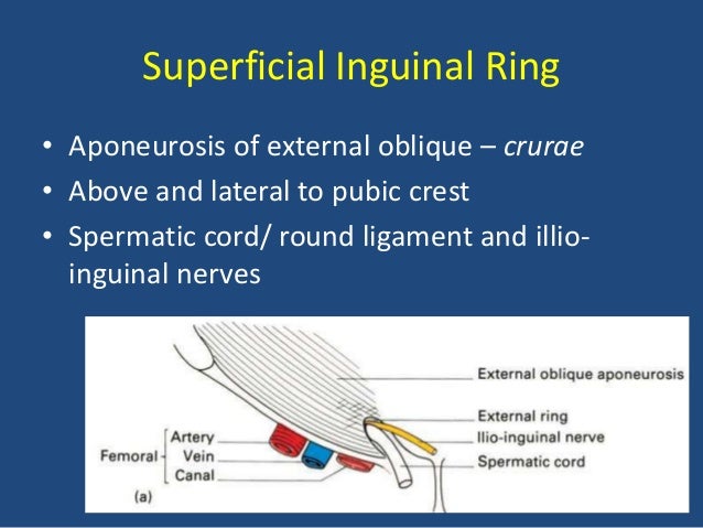 Hernia