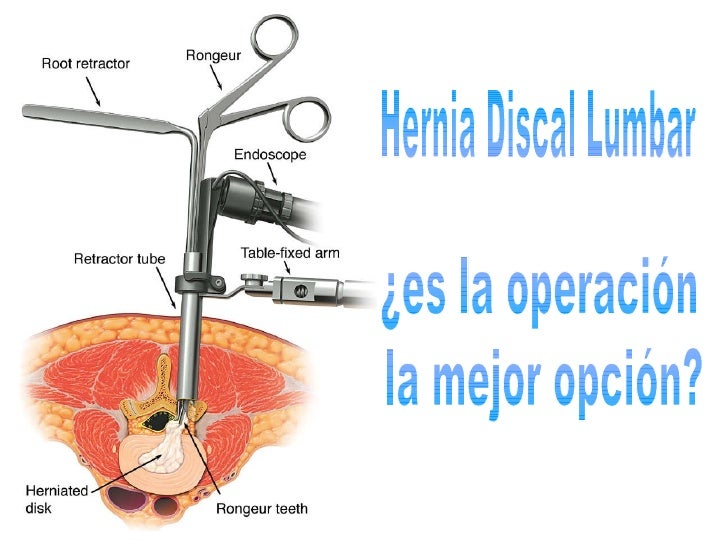 Si duele el lipoma sobre la espalda