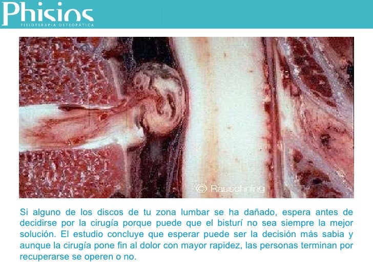 Duele los riñones y da en la parte izquierda y el pie