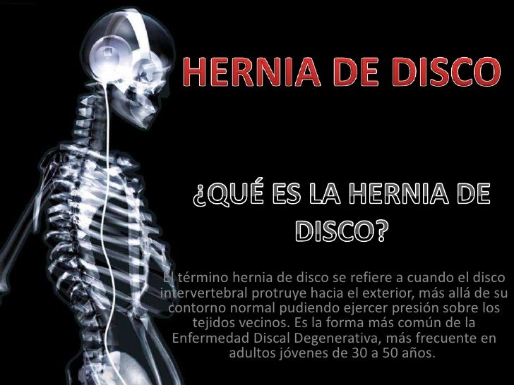 Exame hernia de disco