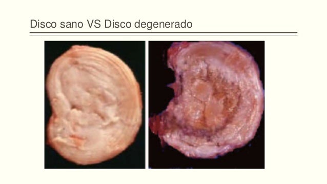 El dolor agudo en el corazón de la espalda