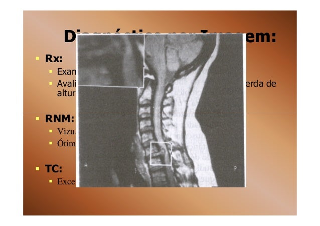 Exame hernia de disco
