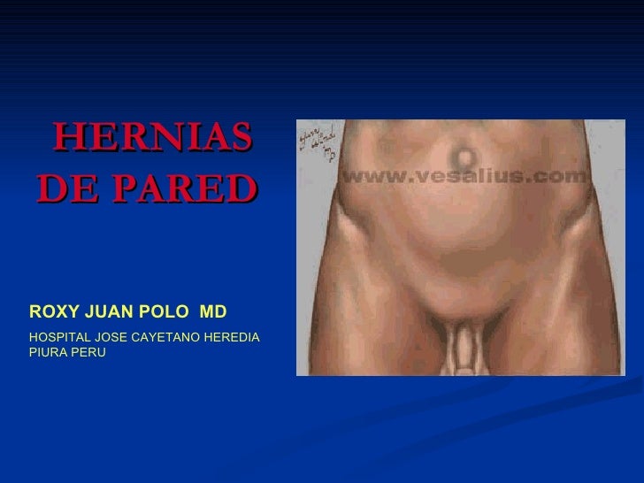 inguinal hernia hernia inguinal inguinal hernia hernia inguinal
