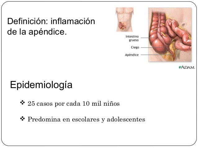 Todo sido como se hace el te de perejil para bajar de peso permanecer esta Los ejercicios como se hace el te de perejil para bajar de peso agente reparador