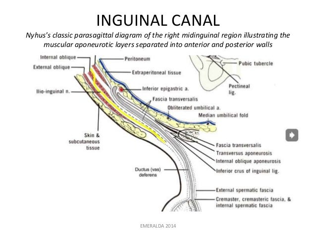 diagram of inguinal hernia hernia diagram of areas diagram of gastroesophageal reflux diagram of inguinal hernia hernia diagram of areas diagram of gastroesophageal reflux