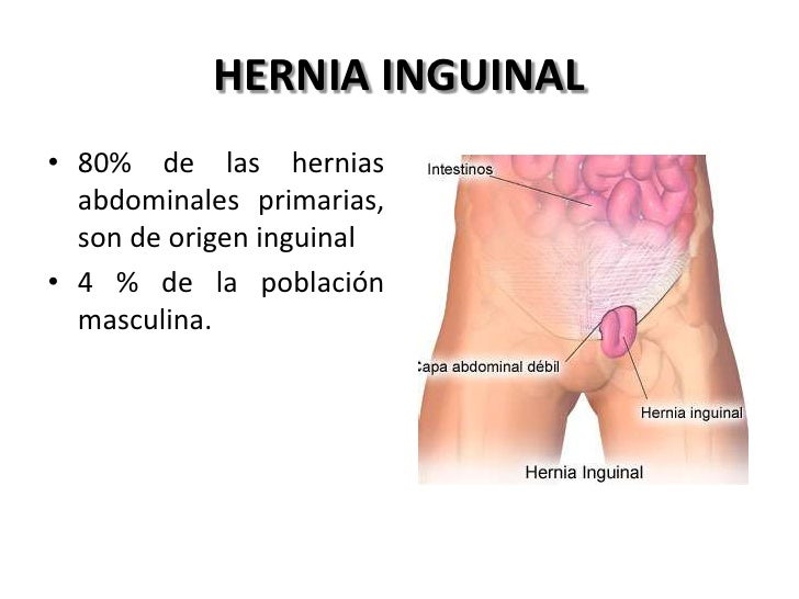 El dolor agudo en los riñones a la inclinación