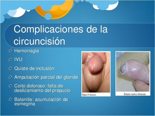 Las causas del pequeño miembro viril
