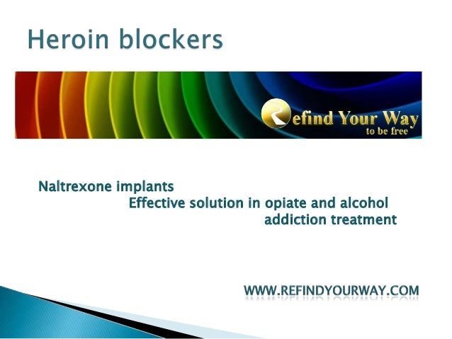 buy naltrexone implant