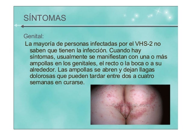 herpes virus 2 pictures #10