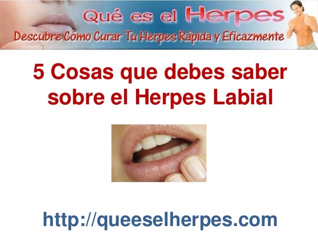 5 Cosas que debes saber sobre El Herpes Labial Adesivos De Parede Infantil Super Herois ~ 5 Cosas que debes saber sobre El Herpes Labial