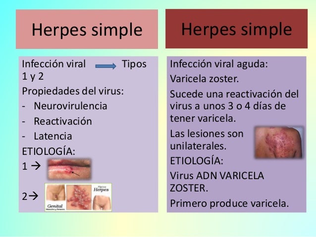 Pictures of Genital Herpes: Symptoms, Treatment, and More