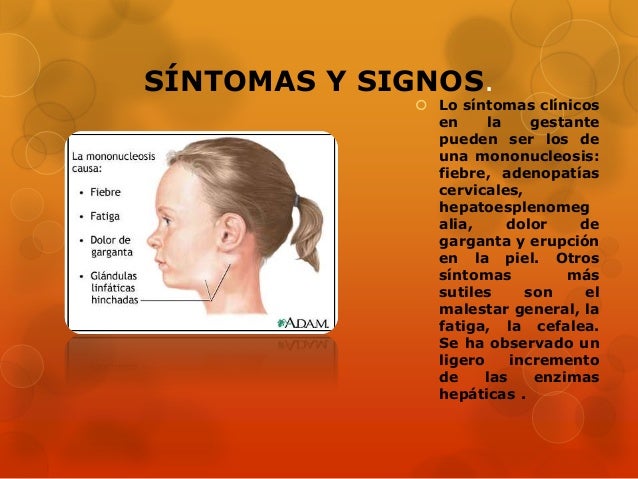 MICROBIOLOGIA Y PARASITOLOGIA DE CITOMEGALOVIRUS, EPSTEIN MICROBIOLOGIA Y PARASITOLOGIA DE CITOMEGALOVIRUS, EPSTEIN