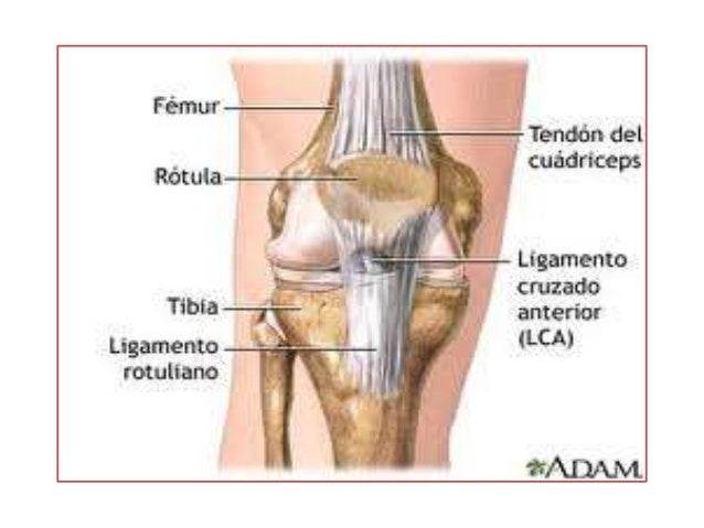 Hidrartrosis de rodilla