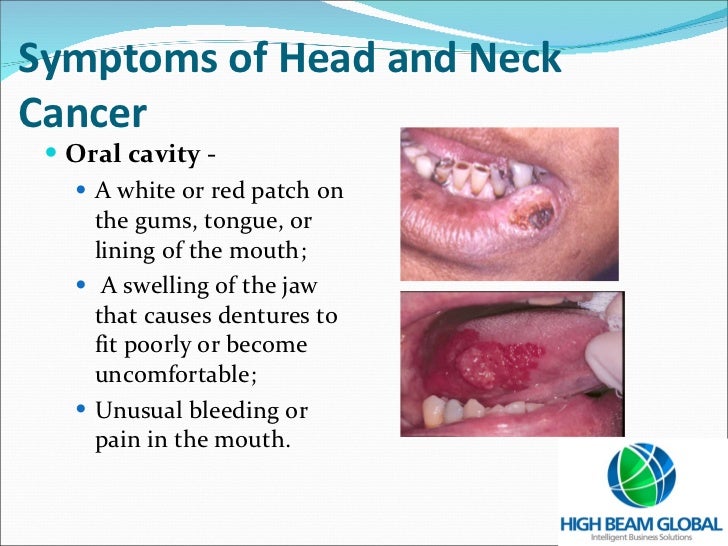 Homeopathic sinus strain remedy sinusitis acute icd9 code