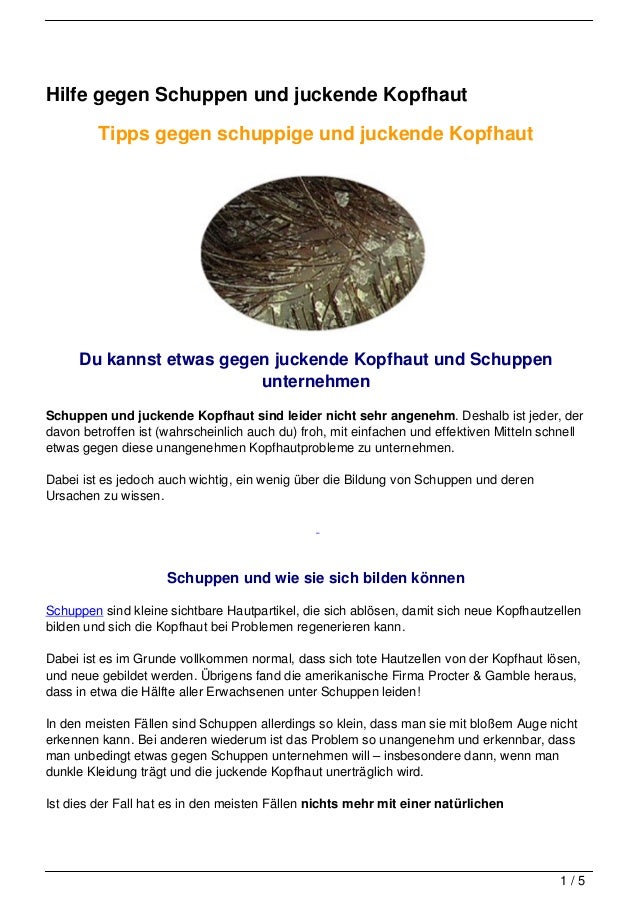 tipps gegen schuppen hilfe gegen schuppen und juckende kopfhaut tipps gegen schuppen hilfe gegen schuppen und juckende kopfhaut