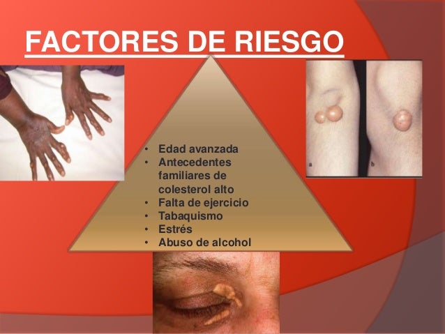 De que sobre la persona hay unos granos purulentos