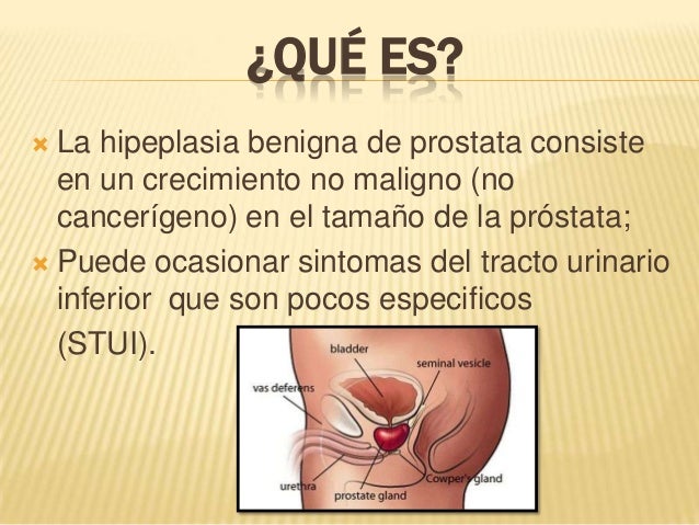 extremo masaje masaje de próstata extremo masaje masaje de próstata
