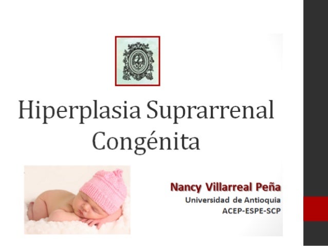 HIPERPLASIA SUPRARENAL hiperplasia suprarenal: