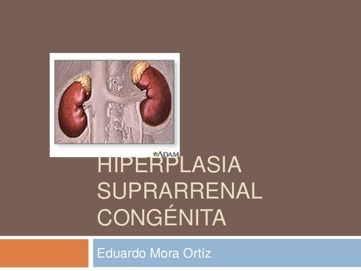 HIPERPLASIA SUPRARENAL hiperplasia suprarenal: