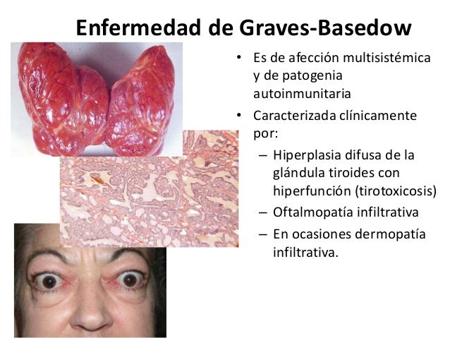 La medicina contra la psoriasis en los pies el ungüento
